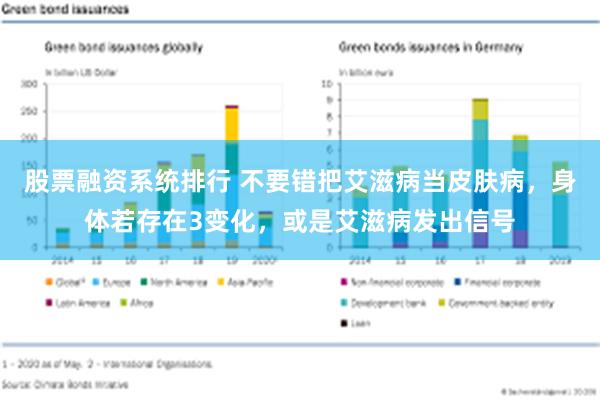 股票融资系统排行 不要错把艾滋病当皮肤病，身体若存在3变化，或是艾滋病发出信号